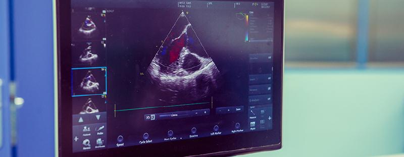Featured image of post Data analysis and inversion